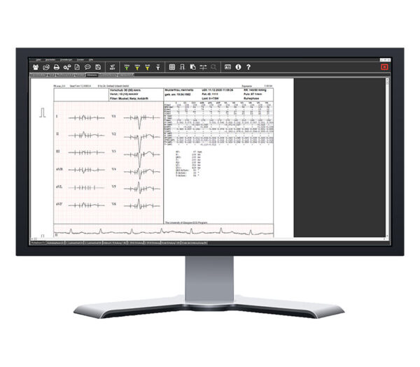 Dr. Gerhard Schmidt SmartScript 12-Kanal PC-Ergometrie-EKG USB (Software Bildschirmansicht 2)