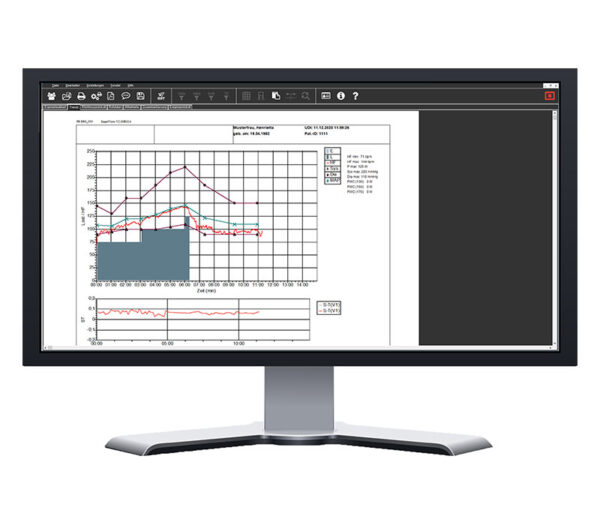 Dr. Gerhard Schmidt SmartScript 12-Kanal PC-Ergometrie-EKG USB (Software Bildschirmansicht 3)