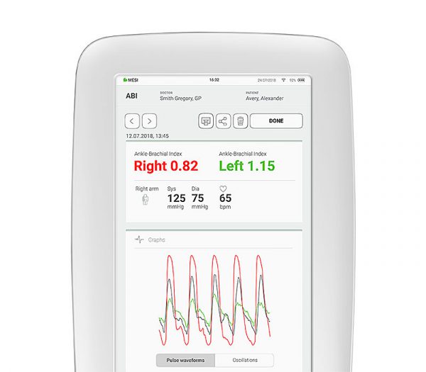 MESI Erweiterungsmodul ABI (Knöchel-Arm-Index) für mTABLET – ABI-App