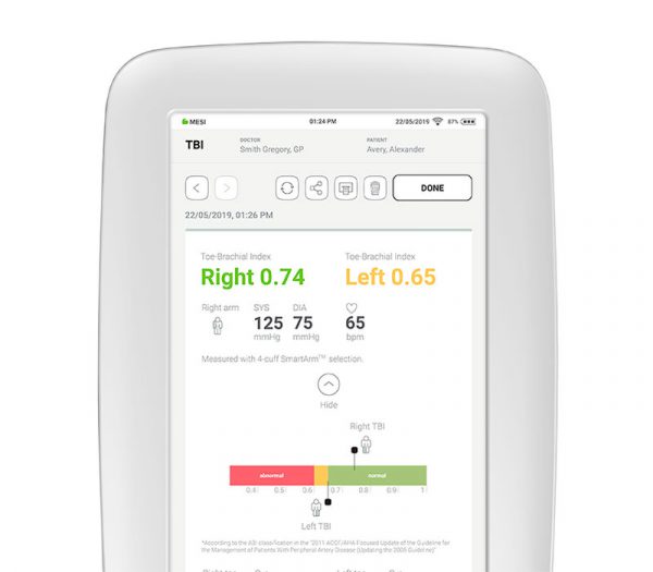 MESI Erweiterungsmodul TBI-Messung (Zehen-Arm-Index) für mTABLET – TBI-App