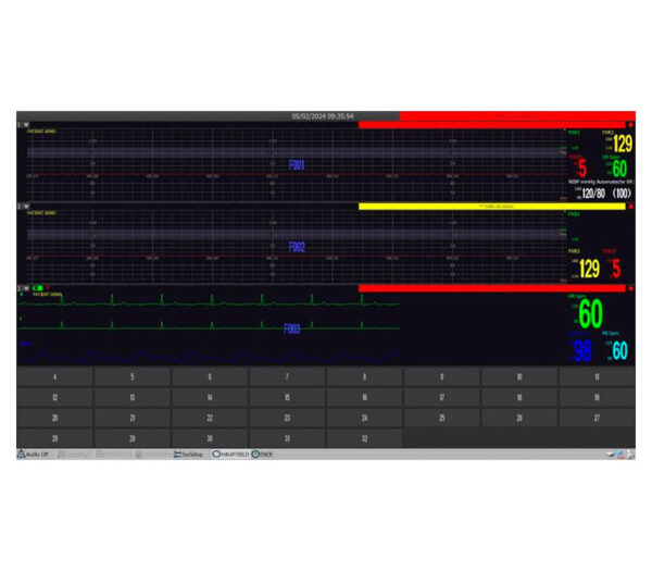 medical ECONET M20 Vitalparameter Monitor – Ansicht PC-Überwachungssoftware (optional)