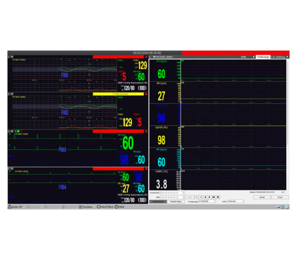 medical ECONET M20 Vitalparameter Monitor – Ansicht PC-Überwachungssoftware (optional)