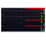 medical ECONET M20 Vitalparameter Monitor – Ansicht PC-Überwachungssoftware (optional)