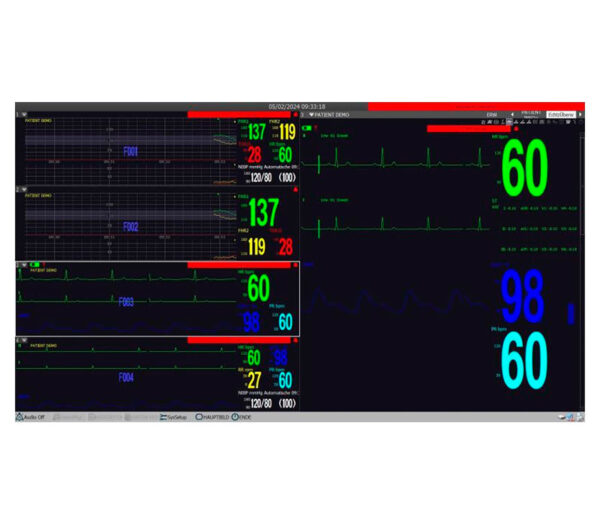 medical ECONET M20 Vitalparameter Monitor – Ansicht PC-Überwachungssoftware (optional)