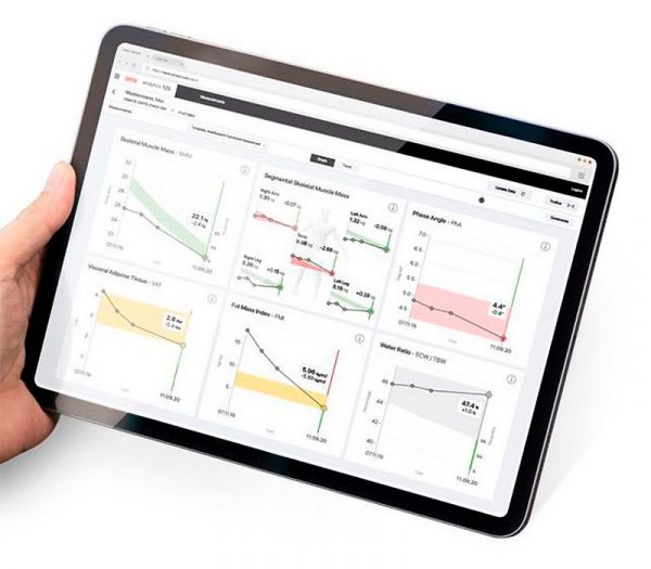 seca analytics 125 Cloud-basierte PC-Software (Anwendungsbeispiel)