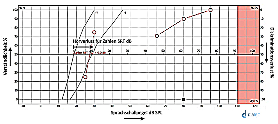 Schaubild - Kurve Diskriminationsverlust