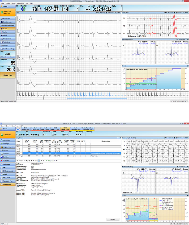 AMEDTEC CardioPart 12 ErgoSpirometrie mit Ergostik