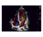 Vinno E35 Farbdoppler-Ultraschallgerät – Bildschirmansicht